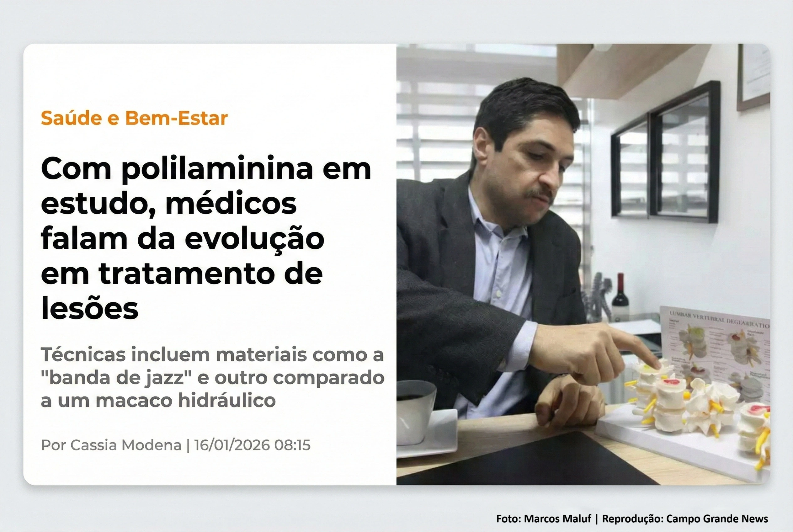 Montagem: Dr. Diego Ramos aponta para modelo de coluna vertebral ao lado da manchete do Campo Grande News sobre Polilaminina e cirurgias modernas. (Foto: Marcos Maluf / Reprodução)