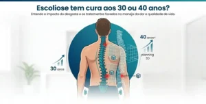 Ilustração de um paciente com escoliose na fase adulta, destacando os pontos de desgaste e dor na coluna, respondendo se a escoliose tem cura aos 30 ou 40 anos.