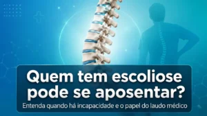 Ilustração de coluna vertebral com escoliose em artigo sobre aposentadoria, incapacidade funcional e laudo médico