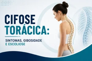 Mulher vista de lado com ilustração da coluna representando cifose torácica e aumento da curvatura das costas.