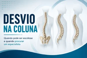 Ilustração mostrando diferentes tipos de desvio na coluna vertebral, incluindo alterações compatíveis com escoliose, cifose e lordose, representando quando procurar avaliação com especialista.
